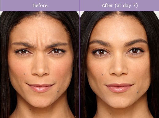 How You Can Get a Chiseled Jawline Like Celebrities Naturally - HubPages